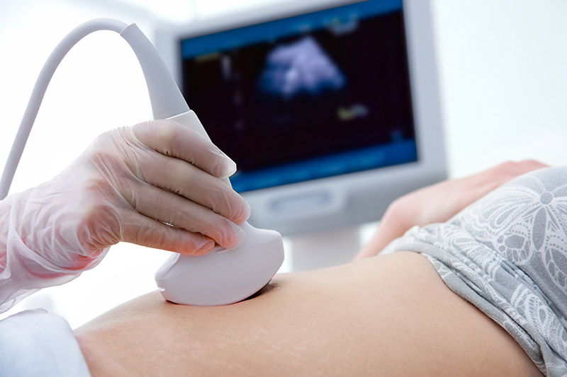 ultra sound photo